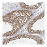 Atlas Antibodies Anti-ANKS1A Antibody