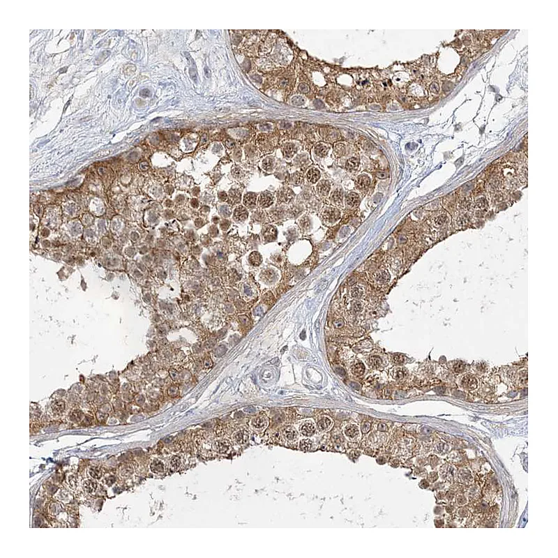 Atlas Antibodies Anti-ANKS1A Antibody