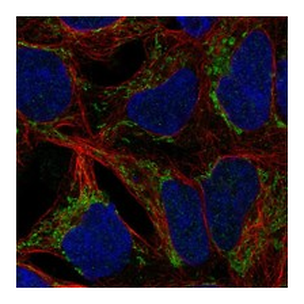 Atlas Antibodies Anti-ANKRD63 Antibody