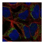 Atlas Antibodies Anti-ANKRD63 Antibody