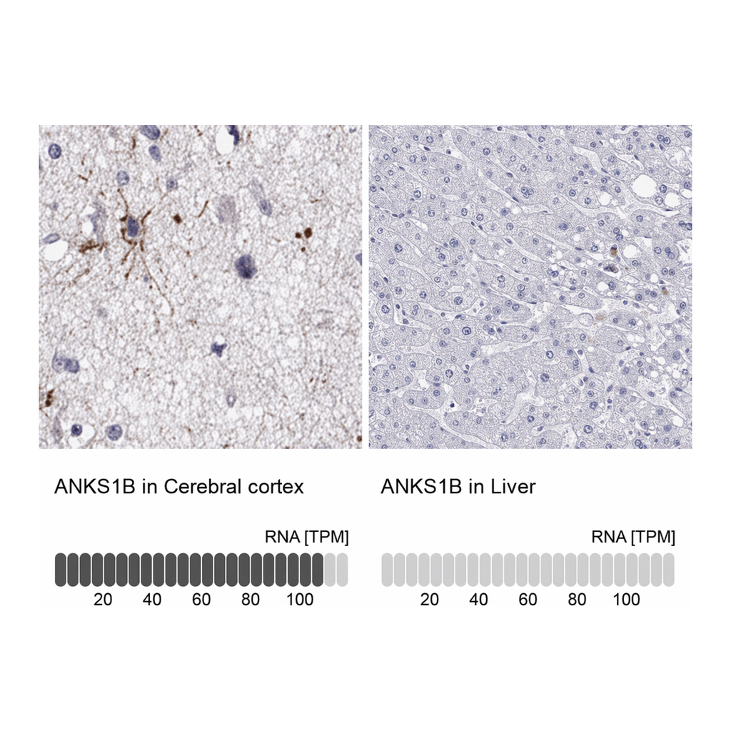 Atlas Antibodies Anti-ANKS1B Antibody