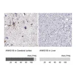 Atlas Antibodies Anti-ANKS1B Antibody