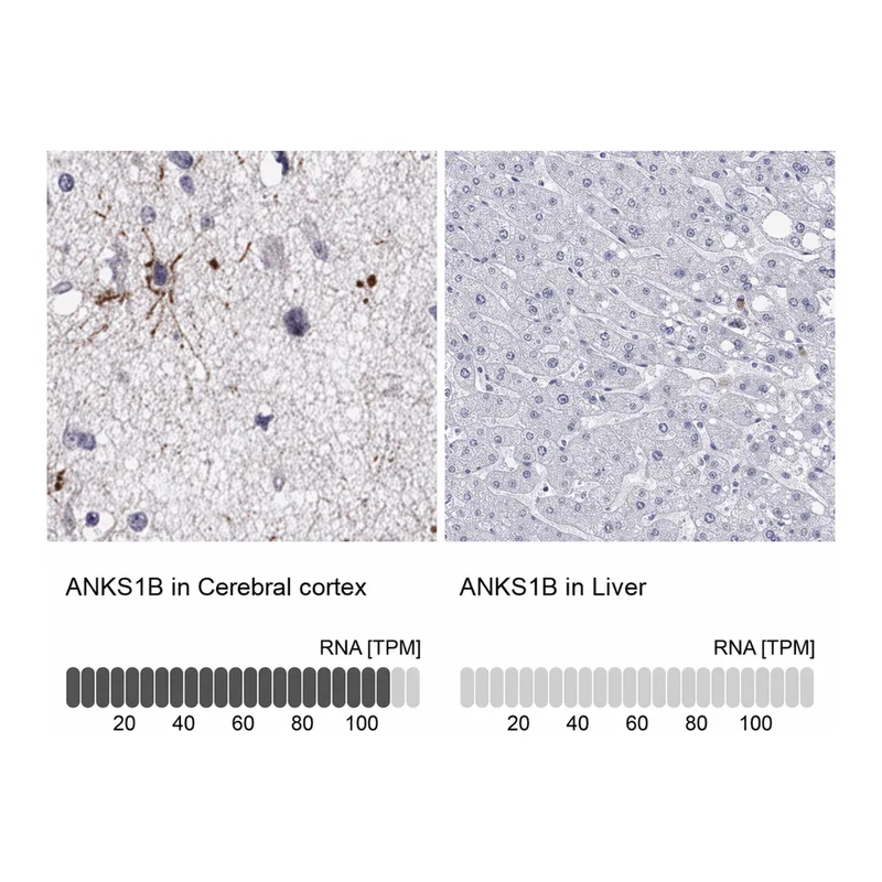 Atlas Antibodies Anti-ANKS1B Antibody