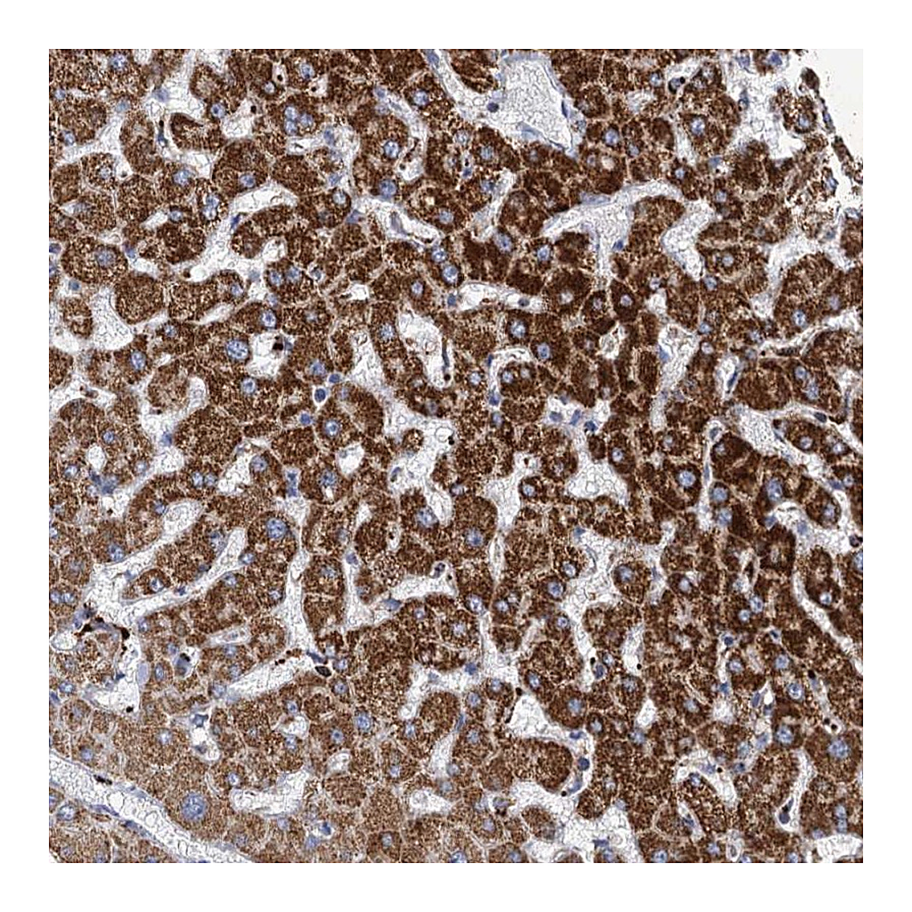 Atlas Antibodies Anti-ANKS3 Antibody