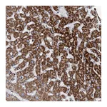 Atlas Antibodies Anti-ANKS3 Antibody