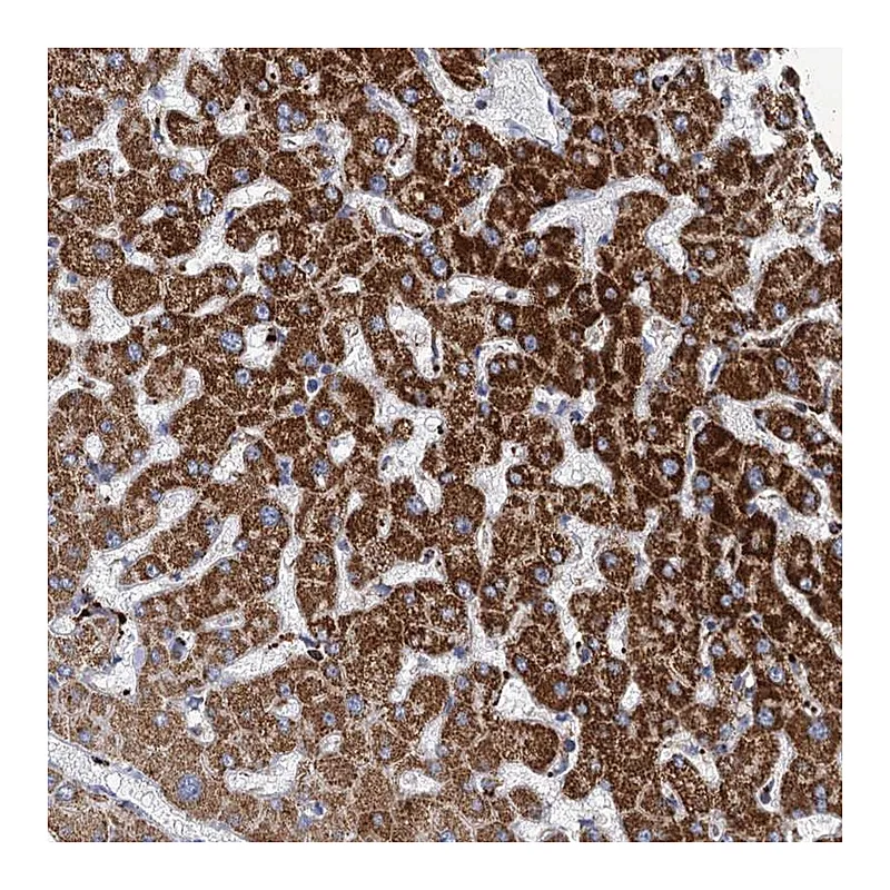 Atlas Antibodies Anti-ANKS3 Antibody