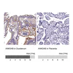 Atlas Antibodies Anti-ANKS4B Antibody