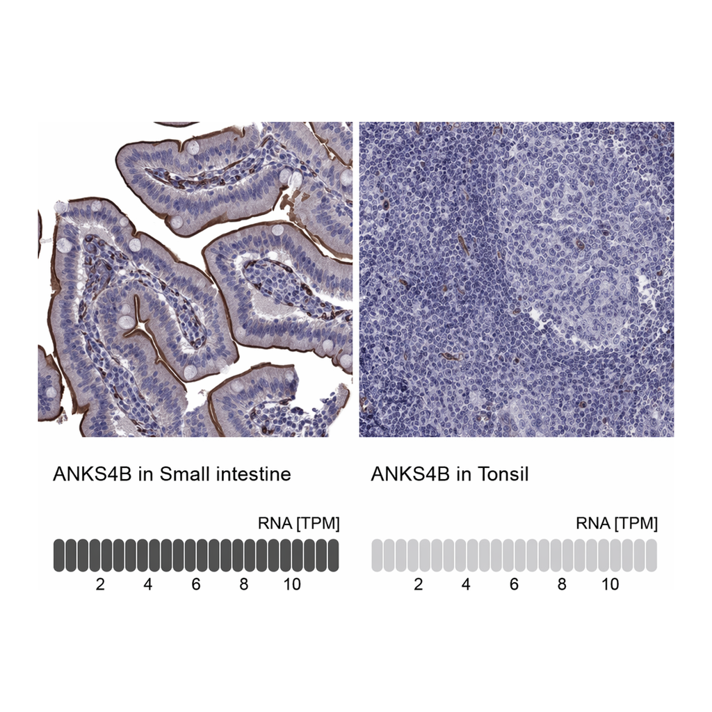 Atlas Antibodies Anti-ANKS4B Antibody
