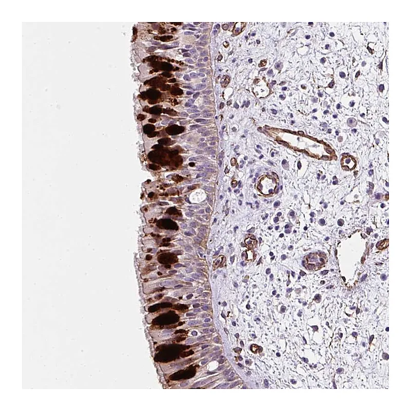 Atlas Antibodies Anti-ANKUB1 Antibody
