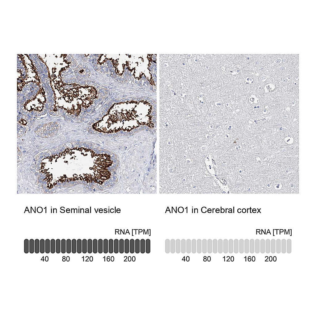 Atlas Antibodies Anti-ANO1 Antibody