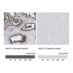 Atlas Antibodies Anti-ANO1 Antibody