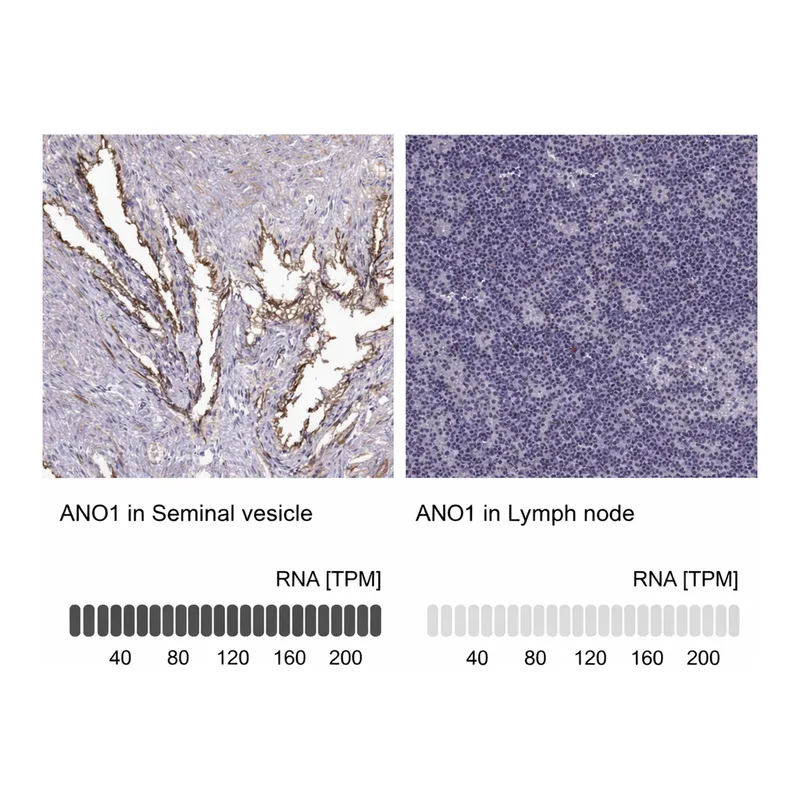 Atlas Antibodies Anti-ANO1 Antibody