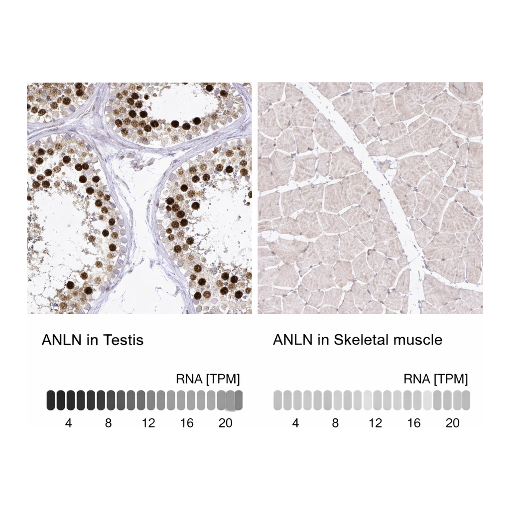 Atlas Antibodies Anti-ANLN Antibody