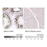 Atlas Antibodies Anti-ANLN Antibody