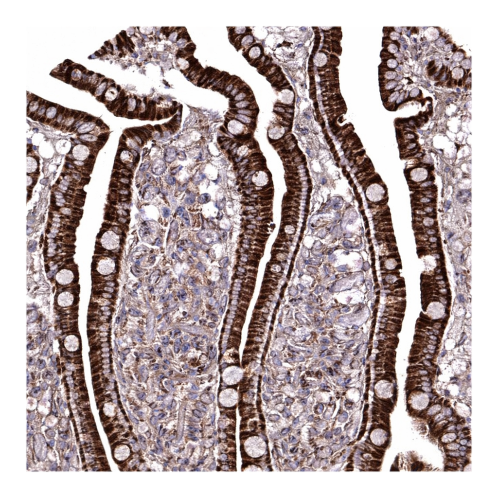 Atlas Antibodies Anti-ANO10 Antibody