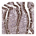Atlas Antibodies Anti-ANO10 Antibody