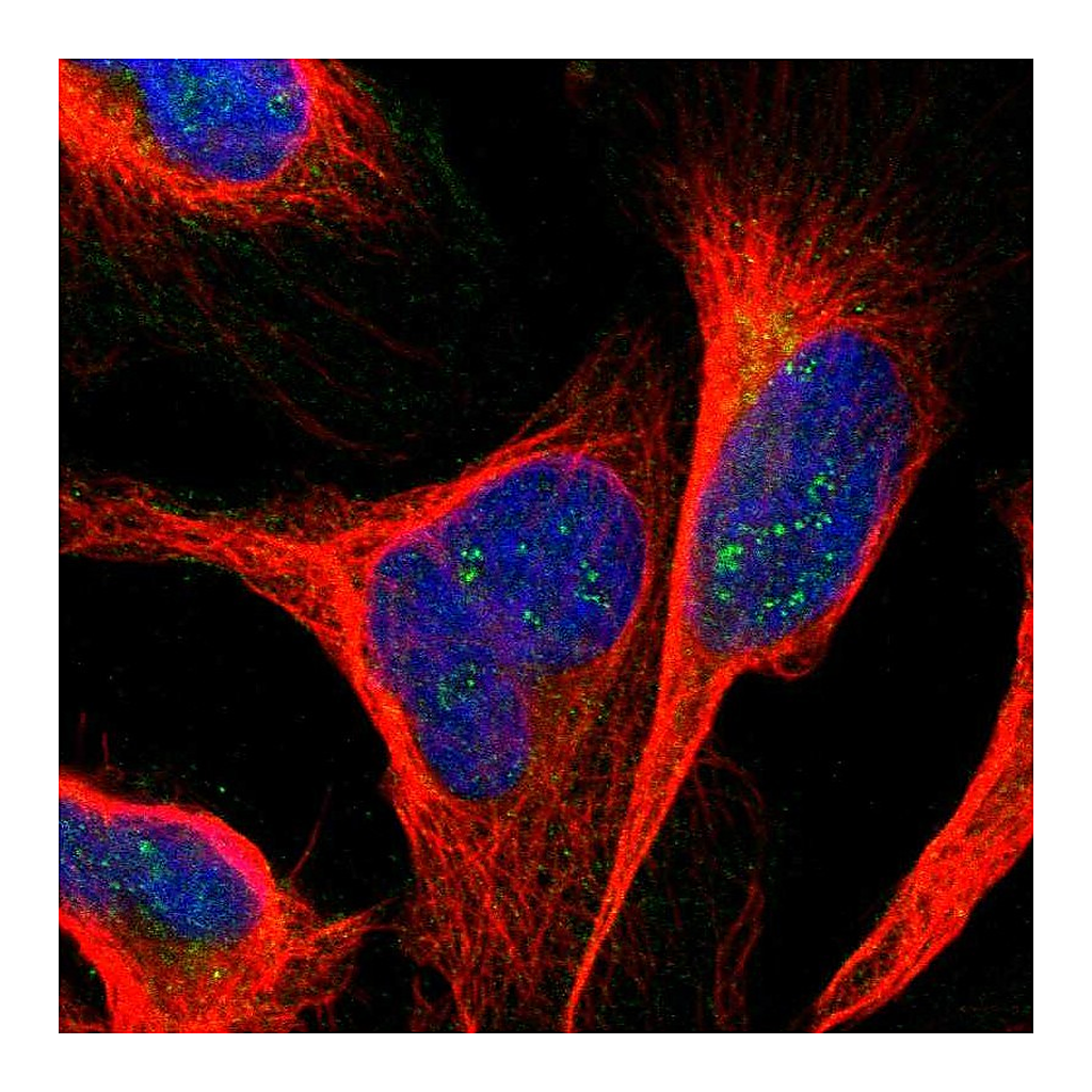 Atlas Antibodies Anti-ANKS6 Antibody