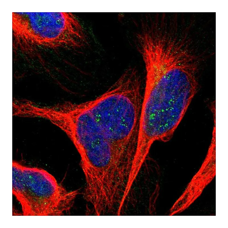 Atlas Antibodies Anti-ANKS6 Antibody
