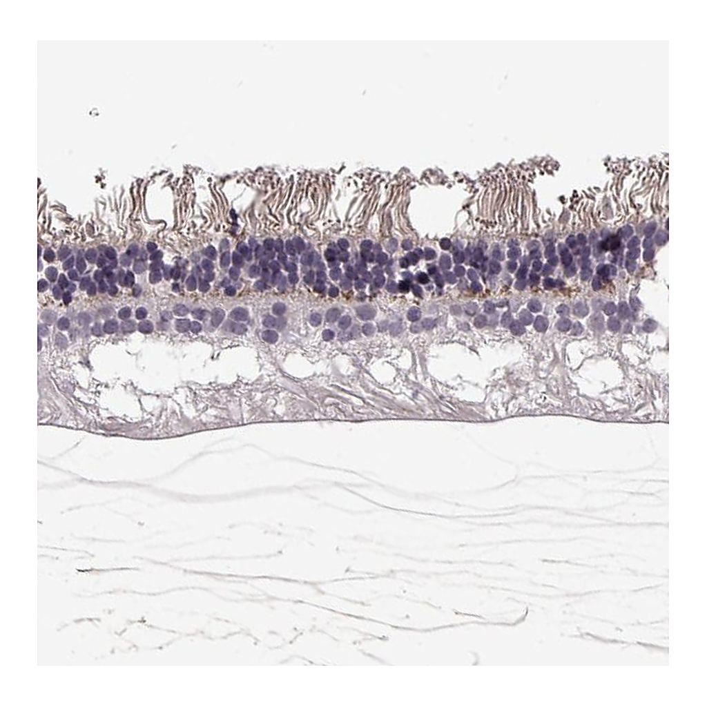 Atlas Antibodies Anti-ANO2 Antibody
