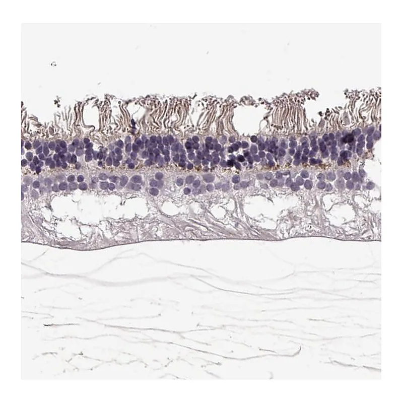 Atlas Antibodies Anti-ANO2 Antibody