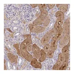 Atlas Antibodies Anti-ANO5 Antibody