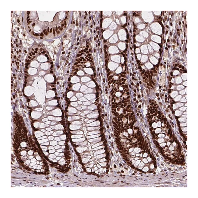 Atlas Antibodies Anti-ANP32A Antibody