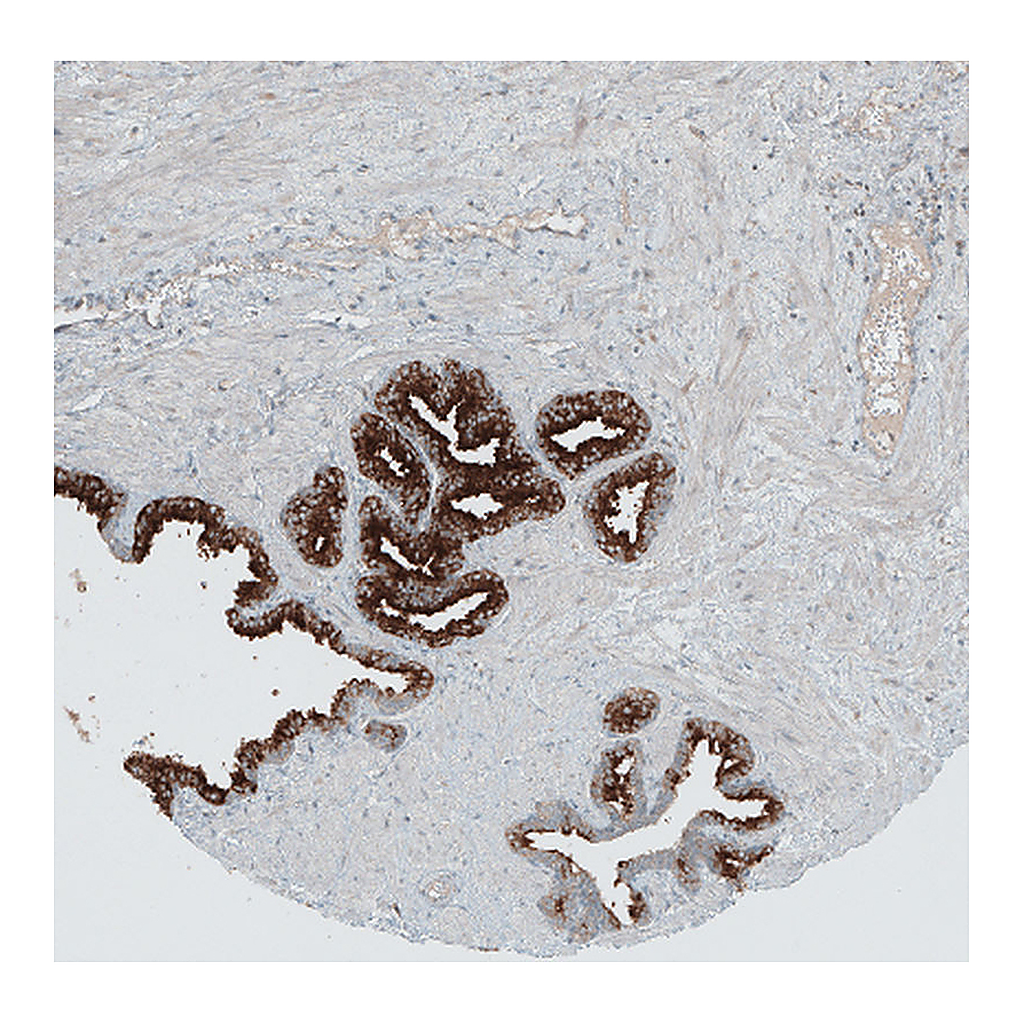 Atlas Antibodies Anti-ANO7 Antibody