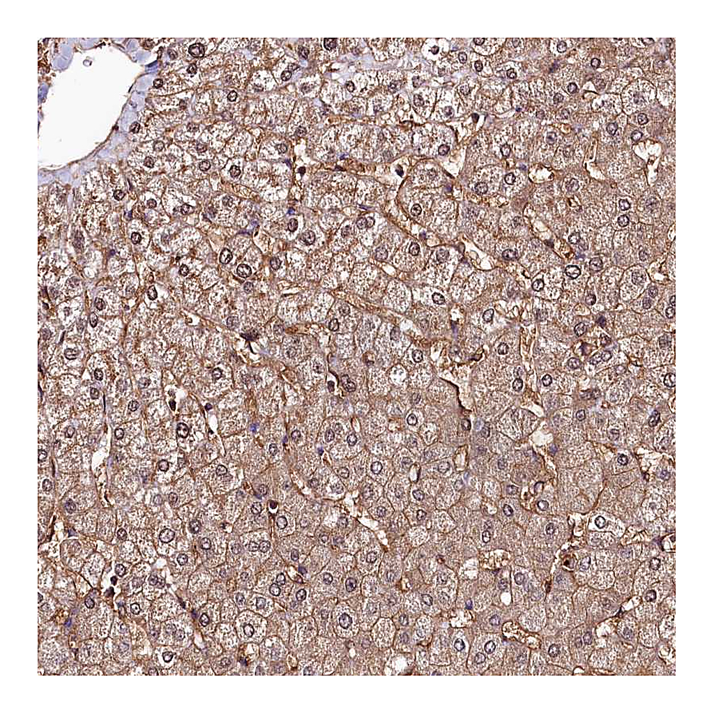 Atlas Antibodies Anti-ANO6 Antibody