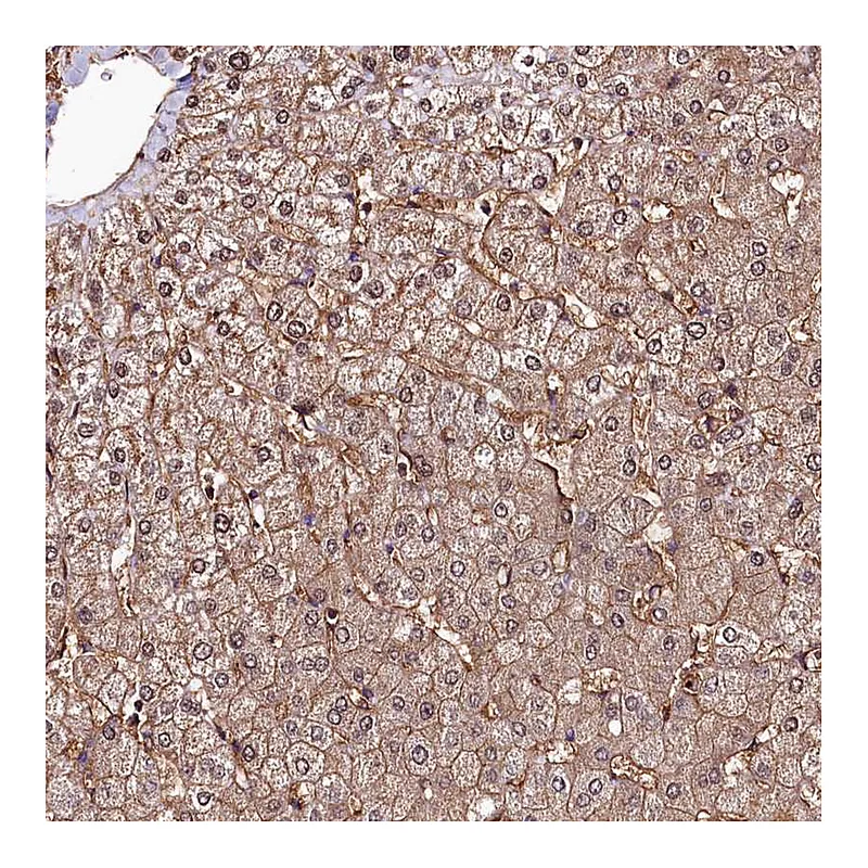 Atlas Antibodies Anti-ANO6 Antibody