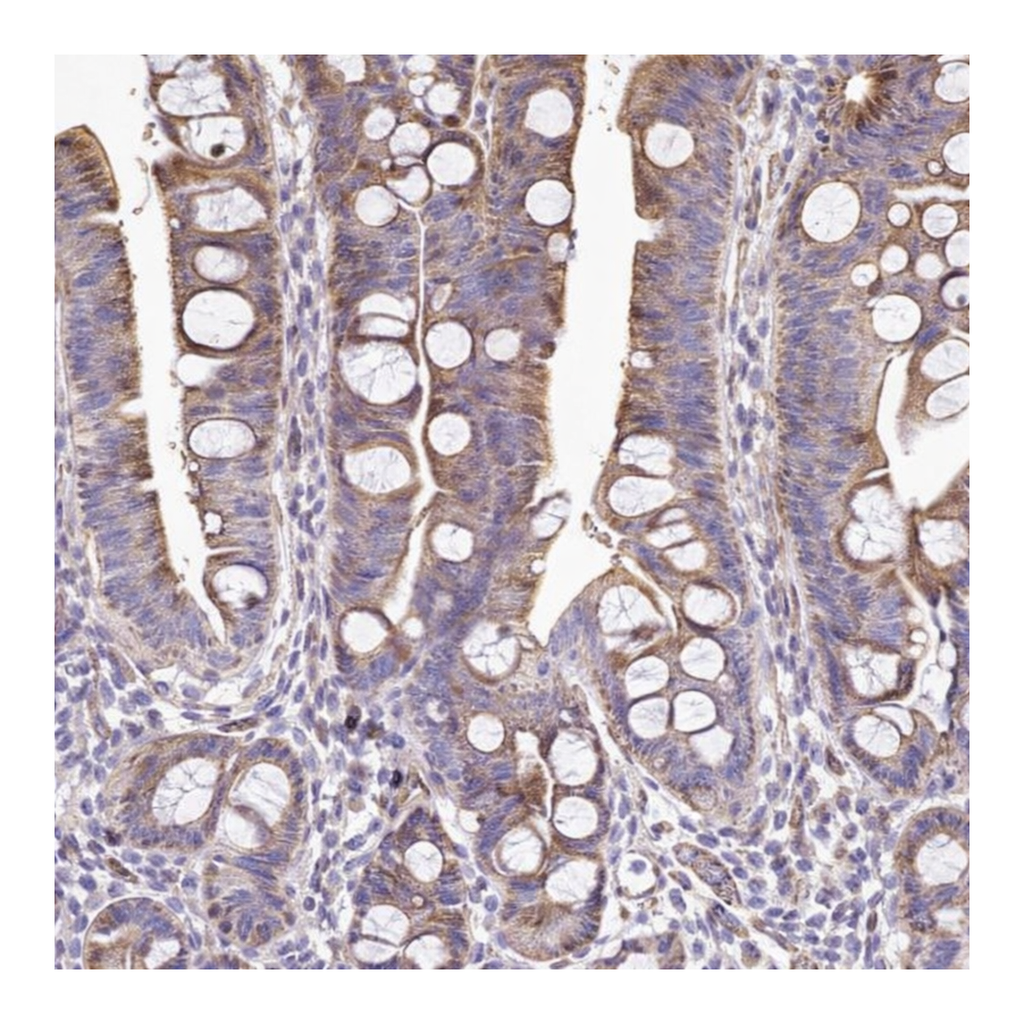 Atlas Antibodies Anti-ANO9 Antibody
