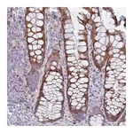 Atlas Antibodies Anti-ANO8 Antibody