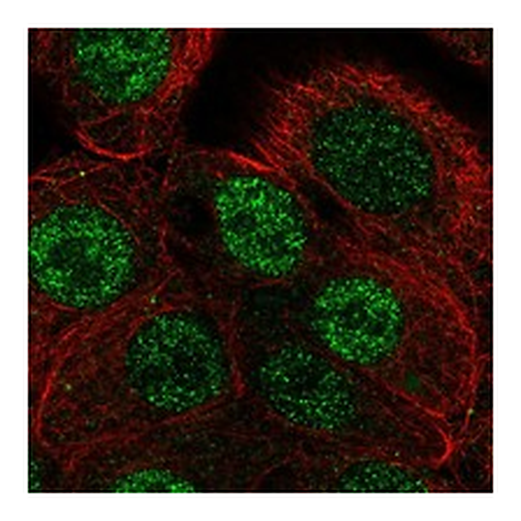 Atlas Antibodies Anti-ANP32B Antibody