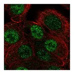 Atlas Antibodies Anti-ANP32B Antibody
