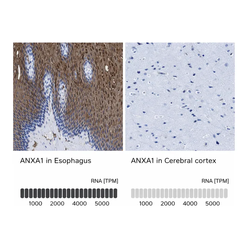 Atlas Antibodies Anti-ANXA1 Antibody