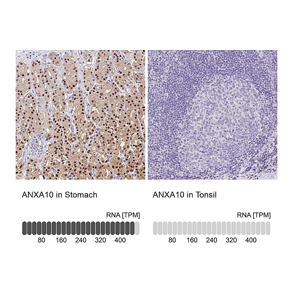 Atlas Antibodies Anti-ANXA10 Antibody