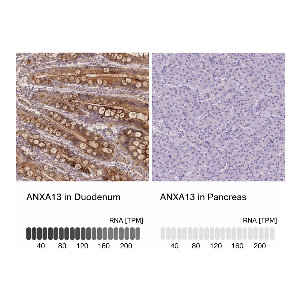 Atlas Antibodies Anti-ANXA13 Antibody