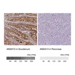 Atlas Antibodies Anti-ANXA13 Antibody
