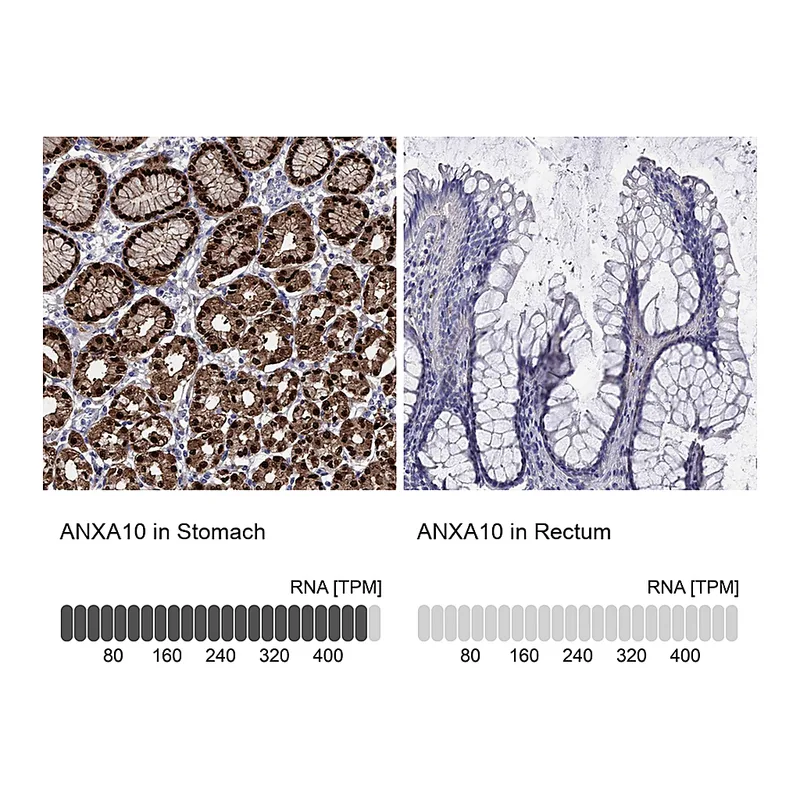 Atlas Antibodies Anti-ANXA10 Antibody