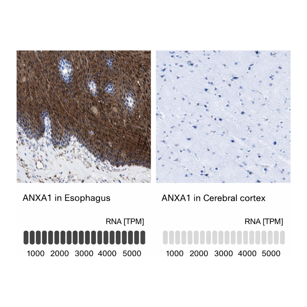 Atlas Antibodies Anti-ANXA1 Antibody