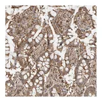 Atlas Antibodies Anti-ANXA11 Antibody