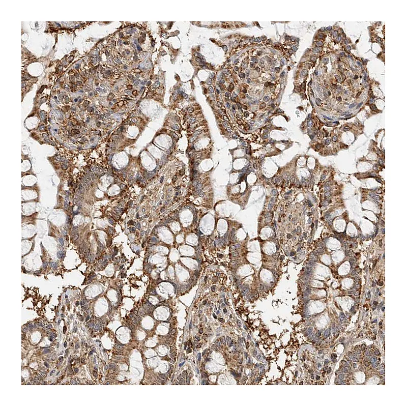 Atlas Antibodies Anti-ANXA11 Antibody