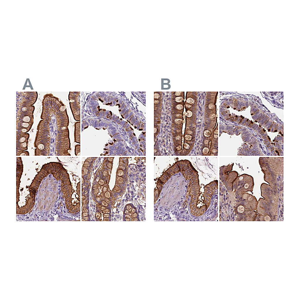 Atlas Antibodies Anti-ANXA13 Antibody