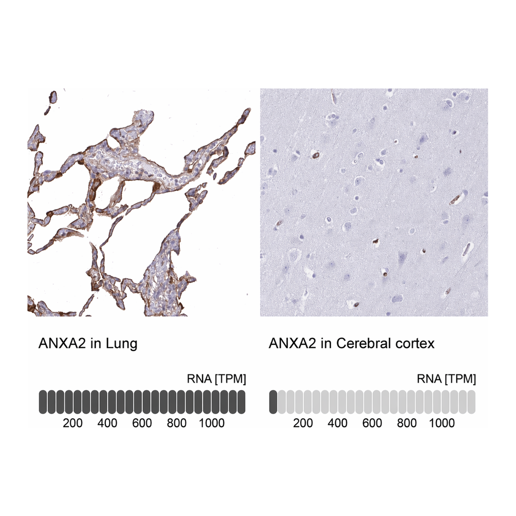 Atlas Antibodies Anti-ANXA2 Antibody