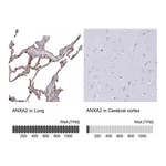 Atlas Antibodies Anti-ANXA2 Antibody