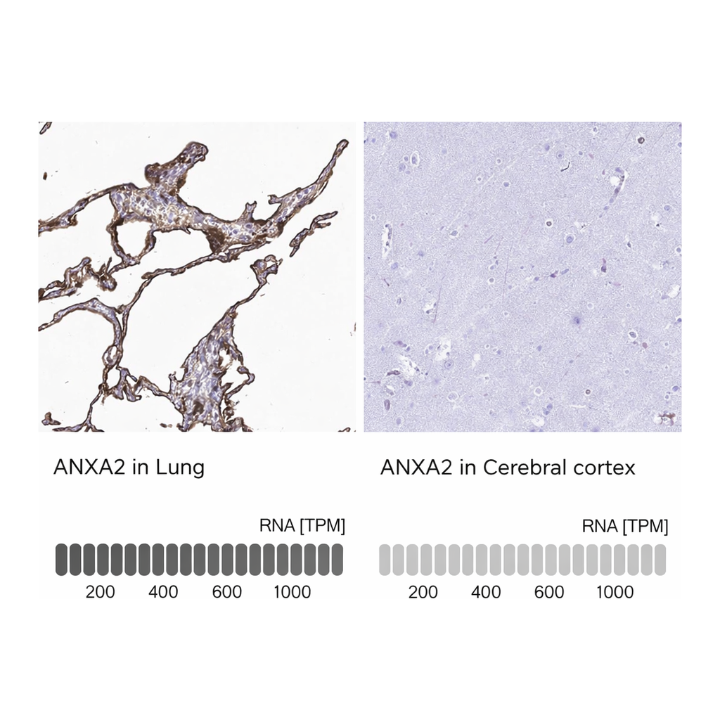 Atlas Antibodies Anti-ANXA2 Antibody