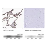 Atlas Antibodies Anti-ANXA2 Antibody