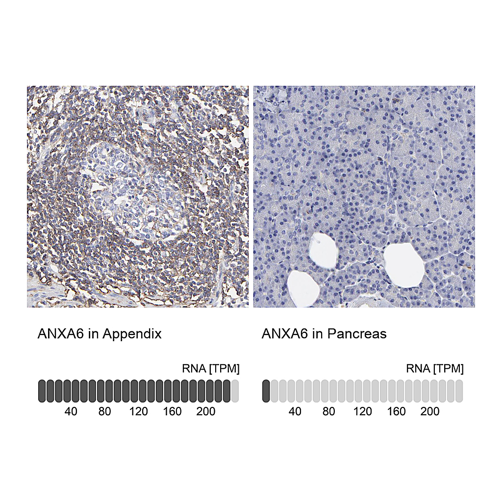 Atlas Antibodies Anti-ANXA6 Antibody