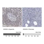 Atlas Antibodies Anti-ANXA6 Antibody