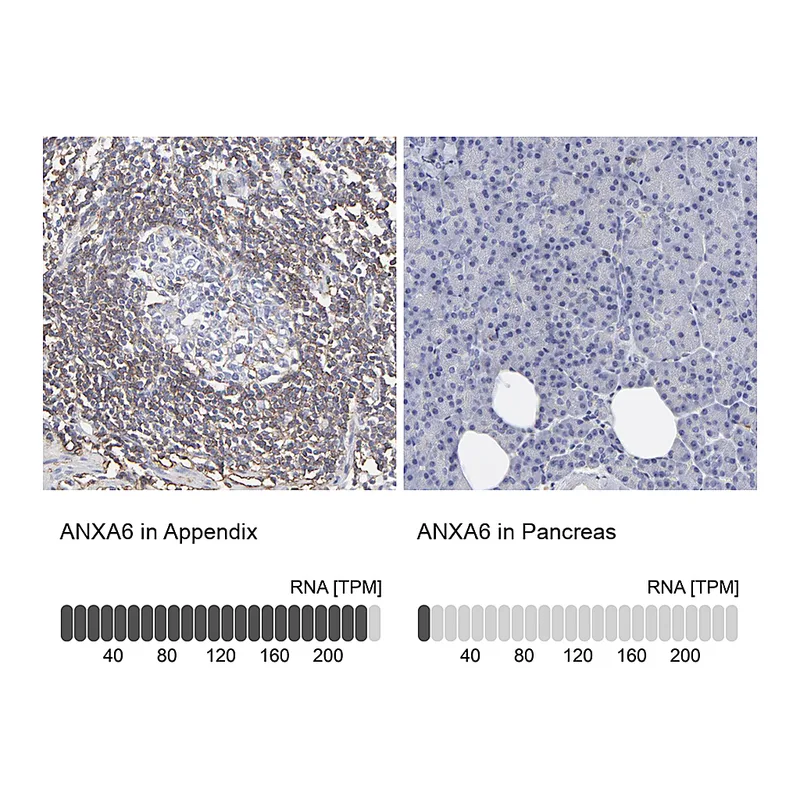 Atlas Antibodies Anti-ANXA6 Antibody
