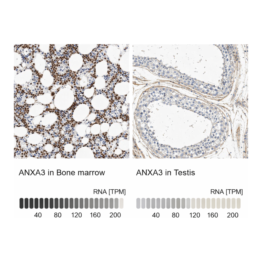 Atlas Antibodies Anti-ANXA3 Antibody